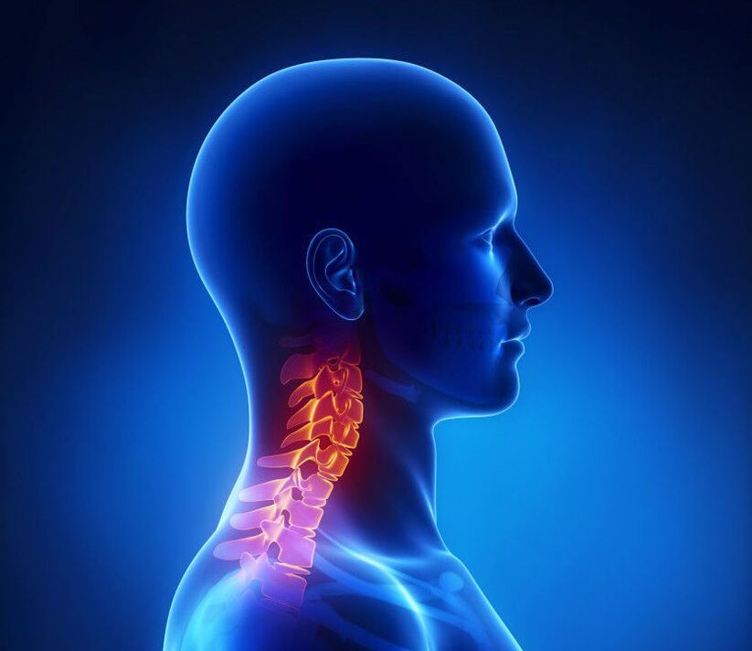 Zervikale Osteochondrose ist eine Pathologie der Wirbelsäule, die Sie zu Hause loswerden können