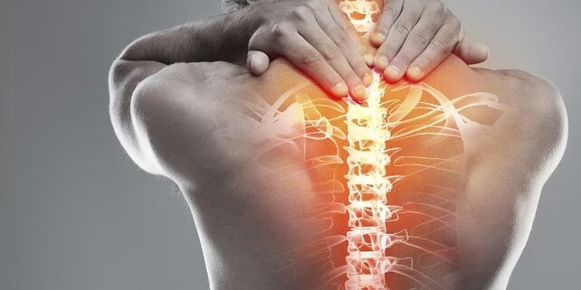 Medizinische Optionen für die Gebärmutterhals -Therapie der Gebärmutterhalsosteochondose