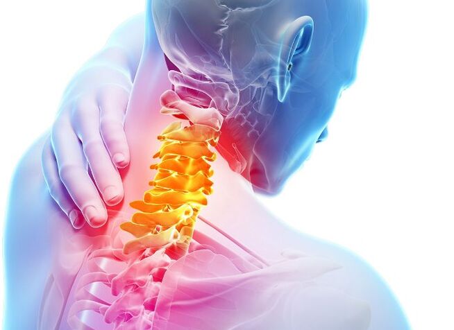 Symptome und Phasen der Entwicklung von zervikaler Osteochondose