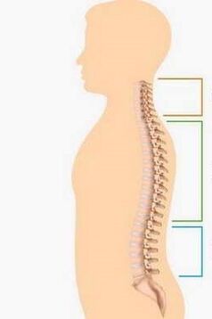 Läsion der Osteochondose verschiedener Teile der Wirbelsäule