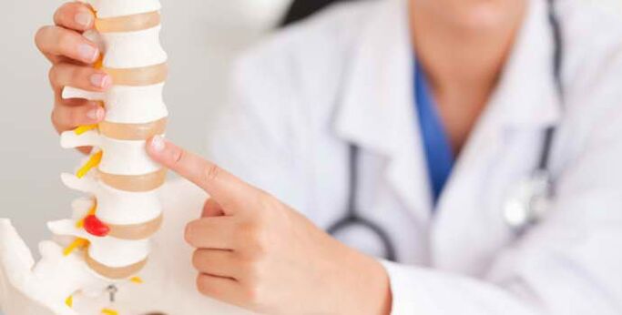 Osteocondrose ist eine Wirbelsäulenerkrankung