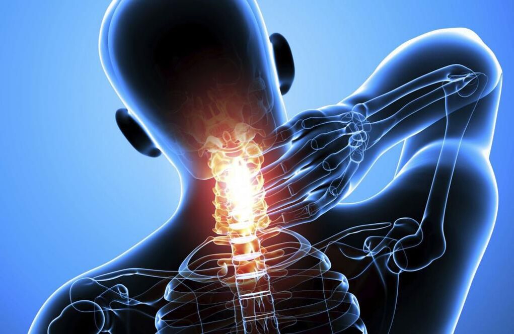 Osteochondrose der Halswirbelsäule